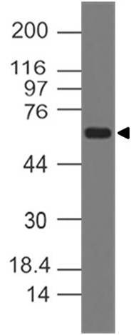 Monoclonal Antibody to RANKL (Clone: ABM12D6)