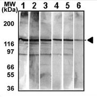 Mouse Monoclonal Antibody to Bi-Phospho-MET/HGFR(Y1234/Y1235) (Clone: 6AT1877)(Discontinued)