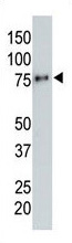 Mouse Monoclonal Antibody to HA Tag (Clone: 12CA5)(Discontinued)