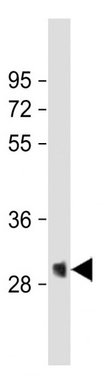 Mouse Monoclonal Antibody to GFP Tag (Clone: 168AT1211)(Discontinued)