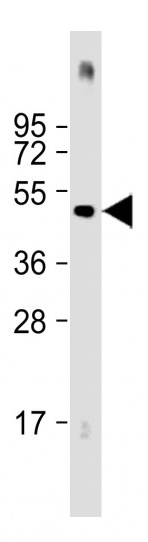 Mouse Monoclonal Antibody to HIS Tag (Clone: 6AT18)(Discontinued)