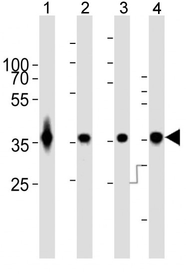 Mouse Monoclonal Antibody to GAPDH (Clone: 1A10A10)(Discontinued)