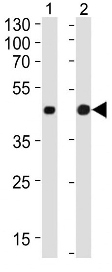 Mouse Monoclonal Antibody to Beta-actin (Clone: 8H10D10)(Discontinued)