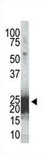 Mouse Monoclonal Antibody to Phospho-mBad(Ser155) (Clone: 27AT381)(Discontinued)