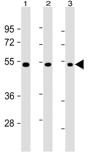 Mouse Monoclonal Antibody to VEGF3 (Clone: 30AT1174.77)(Discontinued)