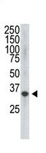 Mouse Monoclonal Antibody to VEGF4 (Clone: 28AT743.288.48)(Discontinued)