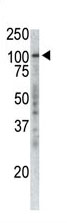 Mouse Monoclonal Antibody to P100 (Clone: 19AT738.292)(Discontinued)