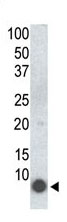 Mouse Monoclonal Antibody to Phospho-PLM(S68) (Clone: 41AT858.235)(Discontinued)