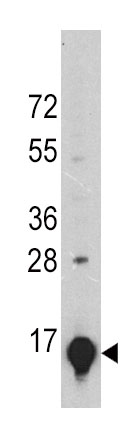 Mouse Monoclonal Antibody to GLT (Clone: 24CT661.4.3)(Discontinued)