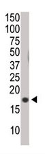 Mouse Monoclonal Antibody to Phospho-Histone H3(S10) (Clone: 44AT1232)(Discontinued)(Discontinued)