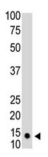 Mouse Monoclonal Antibody to SUMO1 (Clone: 66AT1320)(Discontinued)