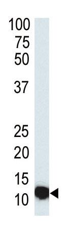 Mouse Monoclonal Antibody to SUMO3 (Clone: 76AT630.91.31)(Discontinued)