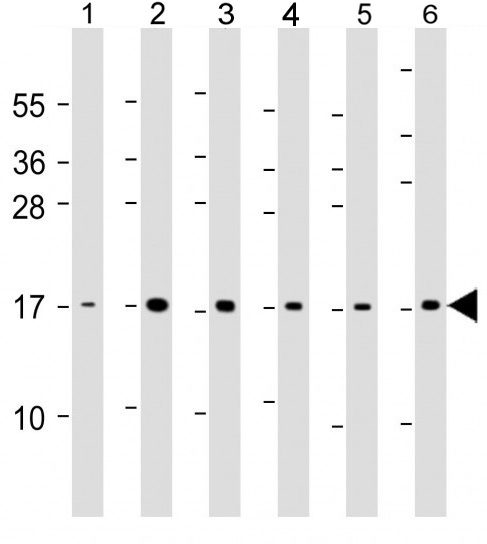 Mouse Monoclonal Antibody to UBC9 (Clone: 67AT1273.95.90)(Discontinued)