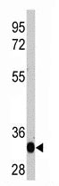 Mouse Monoclonal Antibody to LIN28A (Clone: 55CT58.12.1)(Discontinued)