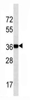 Mouse Monoclonal Antibody to NANOG (Clone: 60CT77.1.1)(Discontinued)