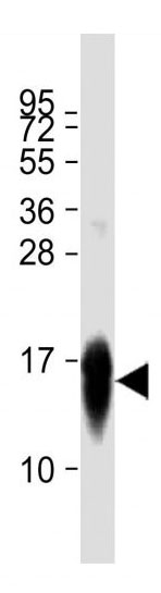 Mouse Monoclonal Antibody to LC3  (APG8)(Clone: 166AT1234)(Discontinued)