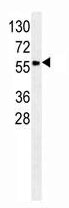 Mouse Monoclonal Antibody to SPA9  (N-term)(Clone: 136CT29.7.4)(Discontinued)