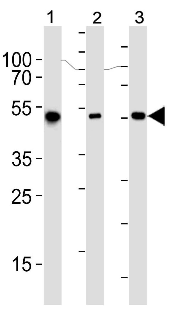 Mouse Monoclonal Antibody to ALDH2 (Clone: 138CT22.3.8)(Discontinued)