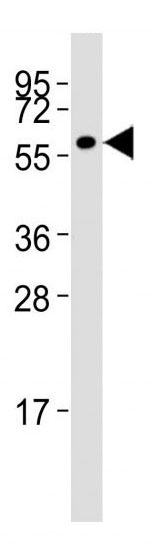 Mouse Monoclonal Antibody to MMP14  (C-term)(Clone: 133CT15.10.5.1)(Discontinued)