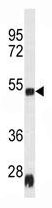 Mouse Monoclonal Antibody to Rat Serpinh1  (Center)(Clone: 134CT3.1.1)(Discontinued)