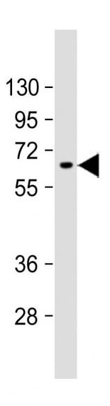 Mouse Monoclonal Antibody to AFP  (N-term)(Clone: 143CT50.11.8)(Discontinued)