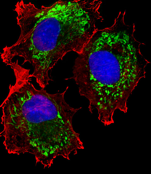 Mouse Monoclonal Antibody to ALDH6A1 (Clone: 147CT8.3.4)(Discontinued)