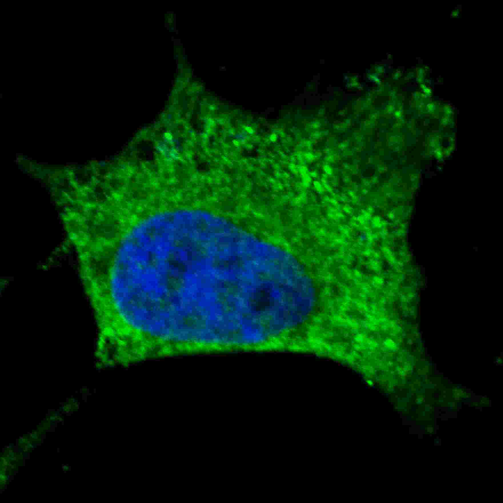 Mouse Monoclonal Antibody to NGFR (Clone: 8G3G10)(Discontinued)