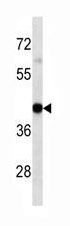 Mouse Monoclonal Antibody to HLA-A (Center)(Clone: 7G7F9)(Discontinued)