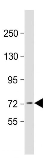 Mouse Monoclonal Antibody to ACOX1 (Clone: 153CT43.1.1)(Discontinued)