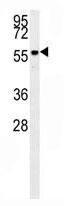 Mouse Monoclonal Antibody to AKT2 (Clone: 148CT5.4.1.4)(Discontinued)