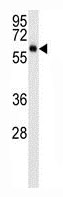 Mouse Monoclonal Antibody to AKT3 (Clone: 154CT4.5.3)(Discontinued)