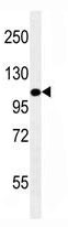 Mouse Monoclonal Antibody to LAMP2 (Clone: 157CT16.6.6)(Discontinued)