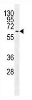 Mouse Monoclonal Antibody to MAPK15 (Clone: 168CT10.6.6)(Discontinued)