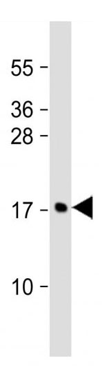 Mouse Monoclonal Antibody to MCFD2 (Clone: 165CT13.1.6)(Discontinued)