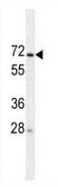 Mouse Monoclonal Antibody to MIPEP (Clone: 166CT22.3.7)(Discontinued)