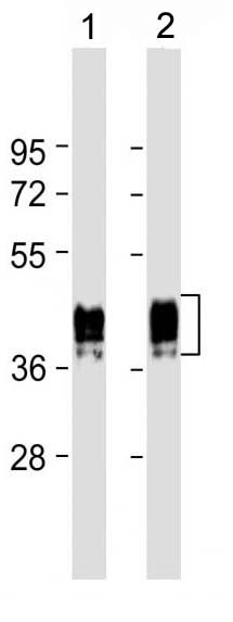 Mouse Monoclonal Antibody to GFAP (Clone: 183CT3.1.5)(Discontinued)