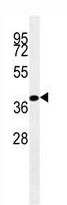 Mouse Monoclonal Antibody to BMP4 (Clone: 192CT7.2.6)(Discontinued)