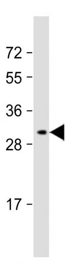 Mouse Monoclonal Antibody to LXN (Clone: 199CT6.1.2)(Discontinued)