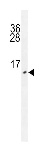 Mouse Monoclonal Antibody to URM1 (Clone: 182CT27.2.2)(Discontinued)