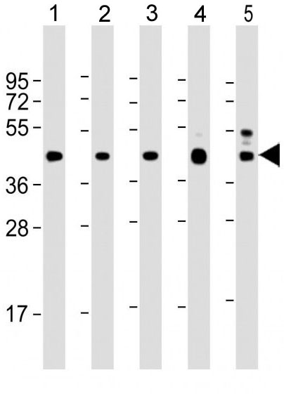 Mouse Monoclonal Antibody to VEGFC (Clone: 197CT7.3.4)(Discontinued)