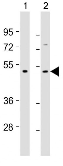 Mouse Monoclonal Antibody to TGFB2 (Clone: 220ct16.4.3.1)(Discontinued)