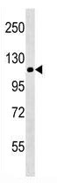 Mouse Monoclonal Antibody to NLRP12 (Clone: 228CT4.1.3)(Discontinued)