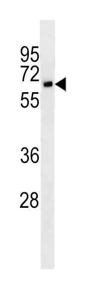 Mouse Monoclonal Antibody to CD25 (Clone: 7G7B6)(Discontinued)