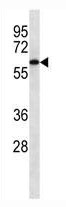 Mouse Monoclonal Antibody to CAMKK2 (Clone: 239CT7.5.3)(Discontinued)