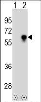 Mouse Monoclonal Antibody to CDC25C (Clone: 233CT9.6.6)(Discontinued)