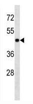 Mouse Monoclonal Antibody to MAPK3 (Clone: 327CT18.1.2)(Discontinued)