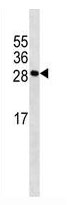 Mouse Monoclonal Antibody to MYOG  (N-term)(Clone: 304CT11.6.1)(Discontinued)