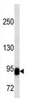 Mouse Monoclonal Antibody to BCL6  (C-term)(Clone: 305CT16.3.3)(Discontinued)