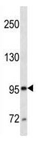 Mouse Monoclonal Antibody to MME/CD10 (Clone: 307CT12.12.5)(Discontinued)