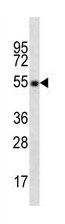 Mouse Monoclonal Antibody to CD4 (Clone: OKT4)(Discontinued)